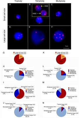 Small Cell Size Circulating Aneuploid Cells as a Biomarker of Prognosis in Resectable Non-Small Cell Lung Cancer